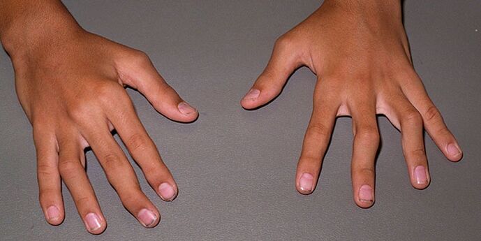 Les articulations des doigts font mal